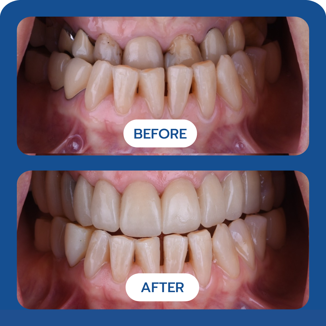 Before and After Case 6